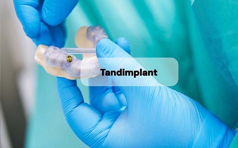 tandimplantat